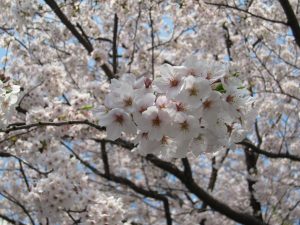 大動脈瘤の治療　ステントグラフト