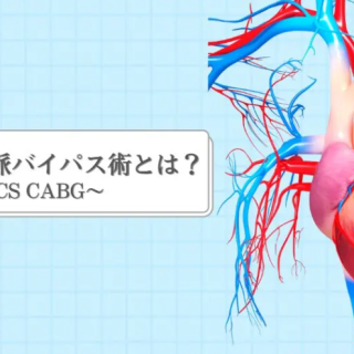MICS CABGのコラムを書きました